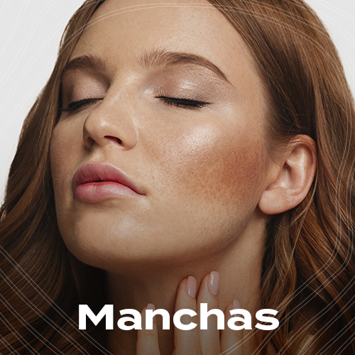 MANCHAS